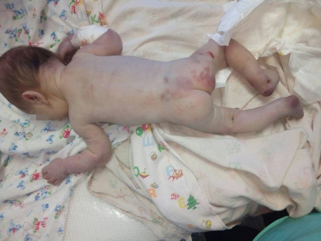 Под больницу в Первомайске подбросили избитого младенца (фото + 18)  Подробнее читайте на Юж-Ньюз: https://xn----ktbex9eie.com.ua/archives/22947