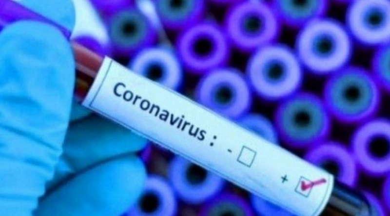 Диагностика, сроки, результаты: что нужно знать о тест-системах для выявления коронавируса Подробнее читайте на Юж-Ньюз: http://xn----ktbex9eie.com.ua/archives/72677