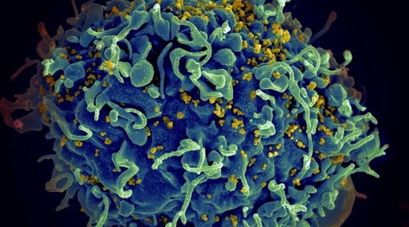 В Японии ученые успешно испытали вакцину от ВИЧ