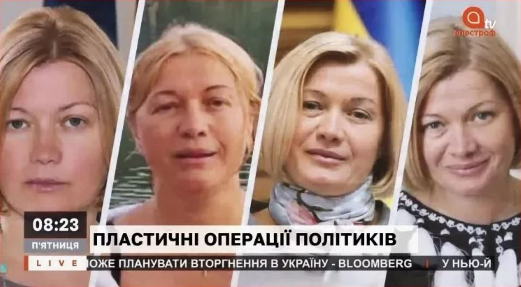 Украинские политики делают пластику: хирург рассказал, что подтянули Тимошенко, Тищенко и Геращенко. Фото.